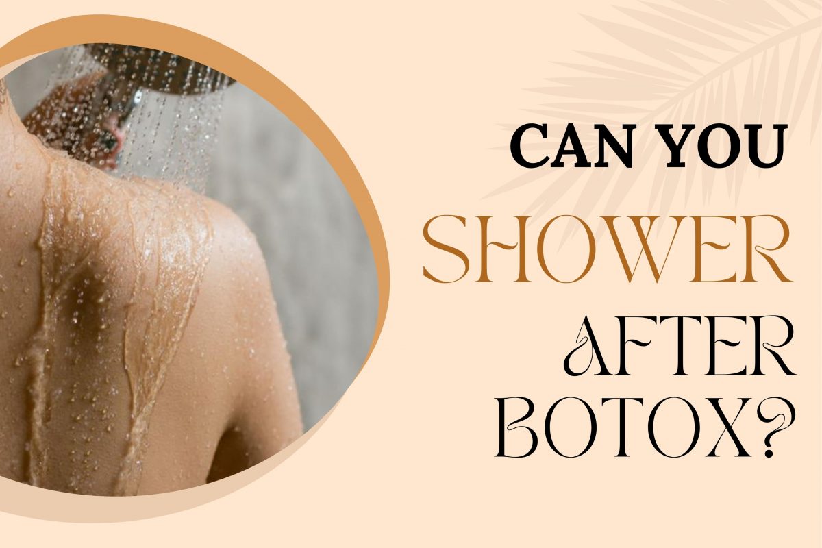 Can You Shower After Botox Fitness Beauty Art