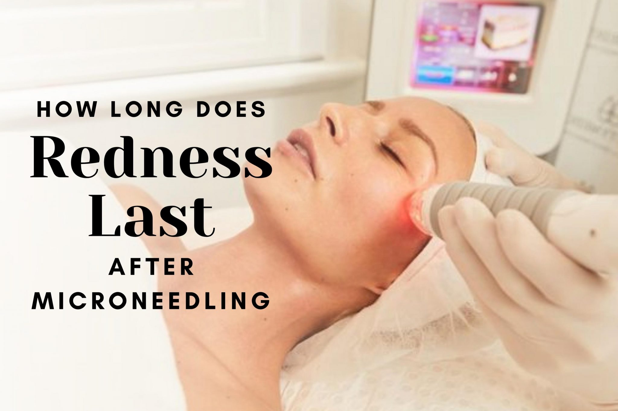 How Long Does Redness Last After Microneedling Fitness Beauty Art